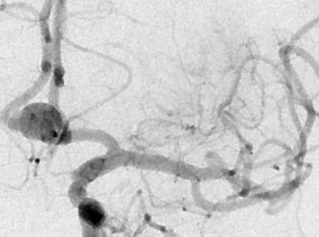 Neuroradiologie / Radiologie - Neurovaskuläres Netzwerk NVN Berlin-Brandenburg